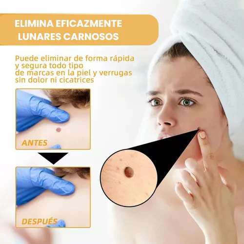 REMOVEDOR SPRAY AEROSOL VERRUGAS