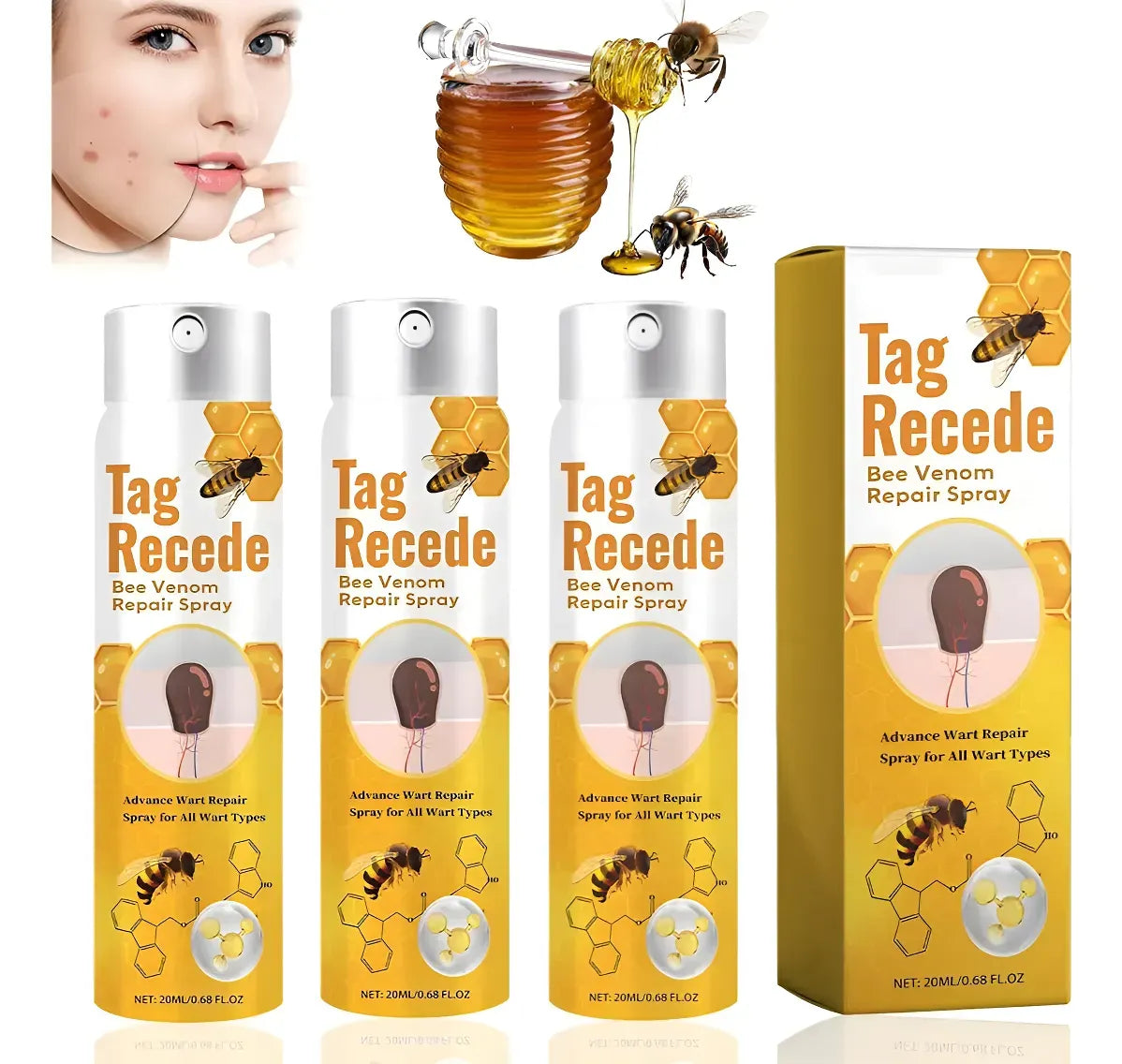 REMOVEDOR SPRAY AEROSOL VERRUGAS